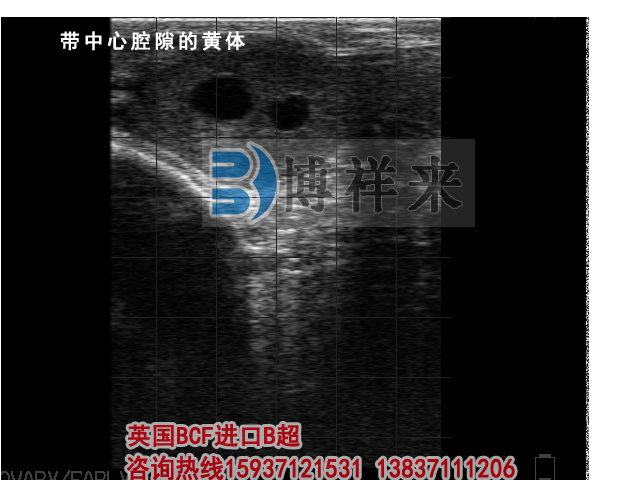 牛用B超檢測(cè)帶中心腔隙黃體影像圖